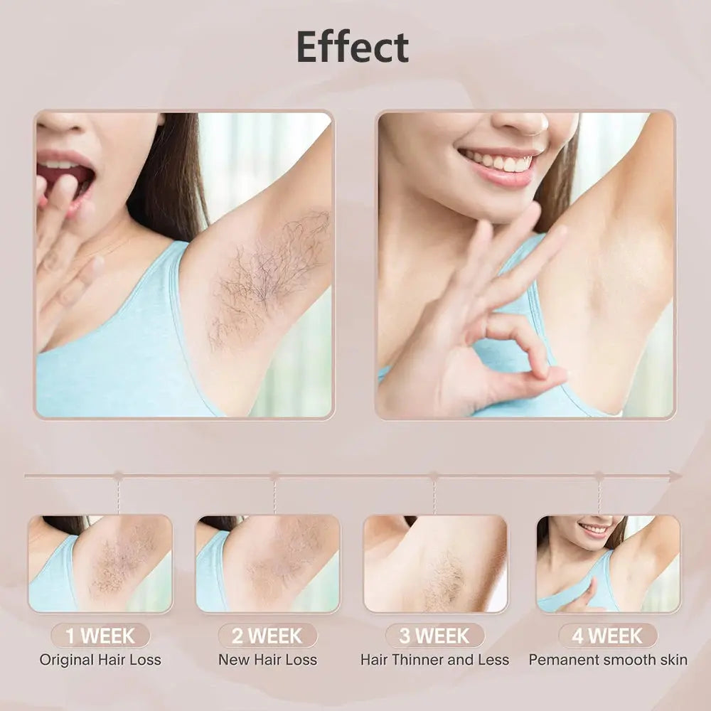 Laser Epilator IPL Hair Removal For Women Body Bikini Facial 990000 Flashes Permanant Painless IPL Hair Remover Laser Epilator NNOS