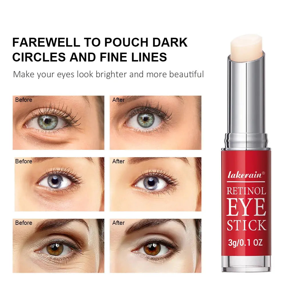Retinol Eye Cream Lightening Dark Circles Firming Skin Instant Eye Repair Serum Stick for women Women Eyes Care NNOS