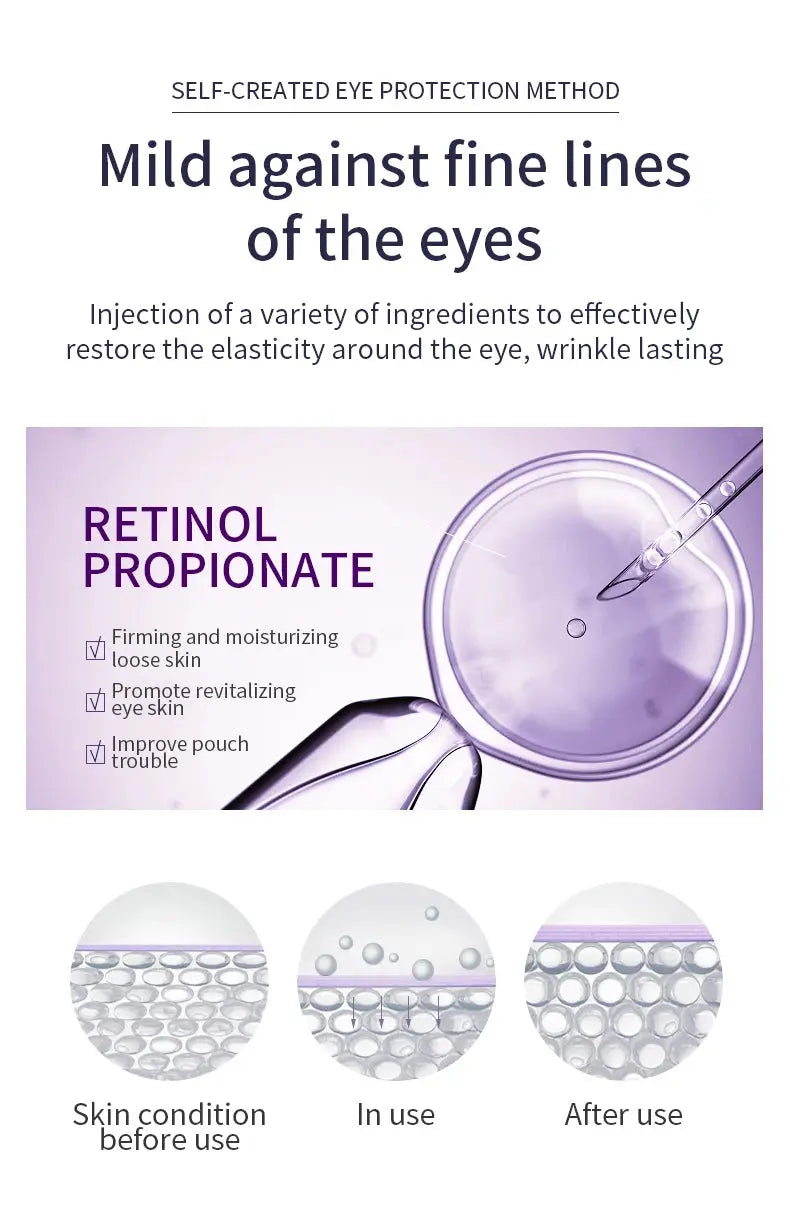 O'CHEAL Anti Wrinkle Anti Dark Circle Eye Cream Roller Massager Moisturizing Eye Bags Anti Aging Hyaluronic Acid Eye Skin Care NNOS