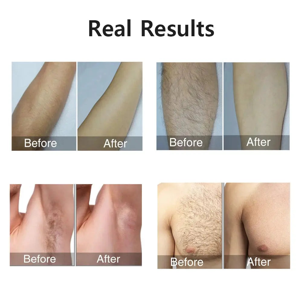 Laser Epilator IPL Hair Removal For Women Body Bikini Facial 990000 Flashes Permanant Painless IPL Hair Remover Laser Epilator NNOS