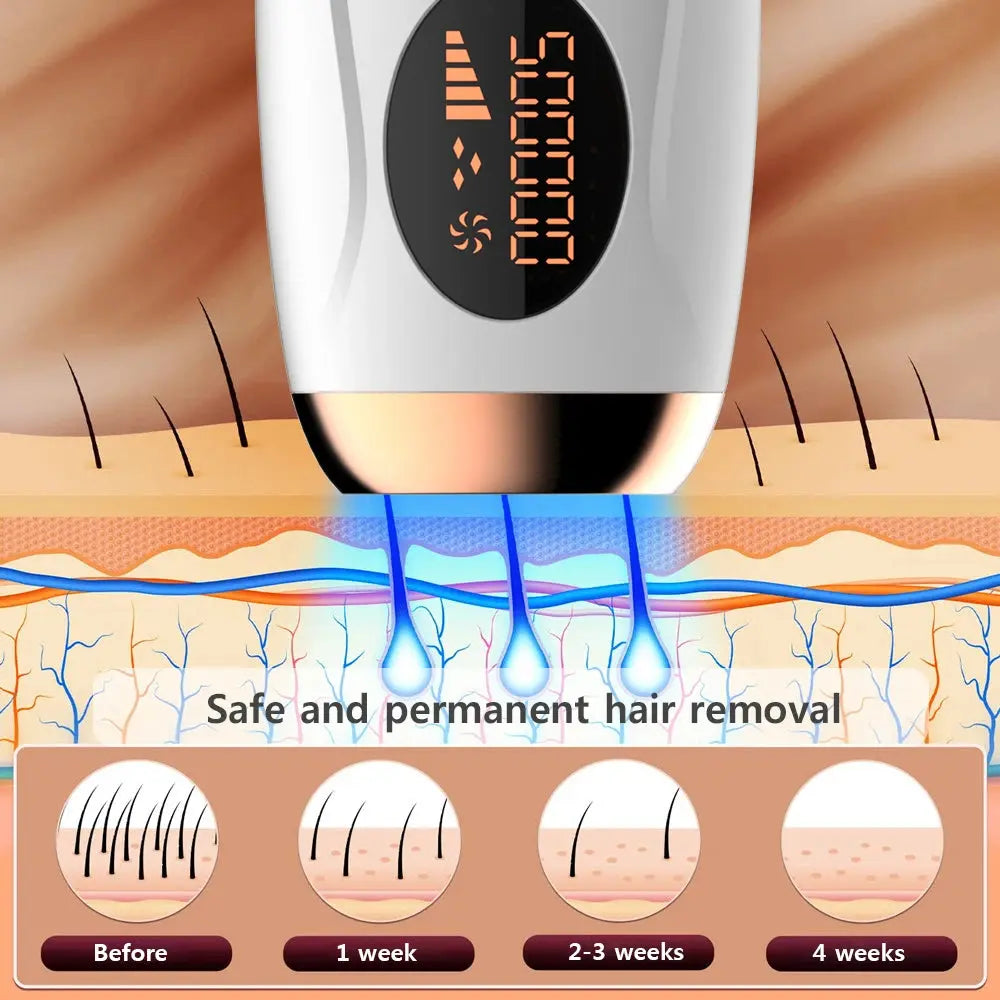 Laser Epilator IPL Hair Removal For Women Body Bikini Facial 990000 Flashes Permanant Painless IPL Hair Remover Laser Epilator NNOS