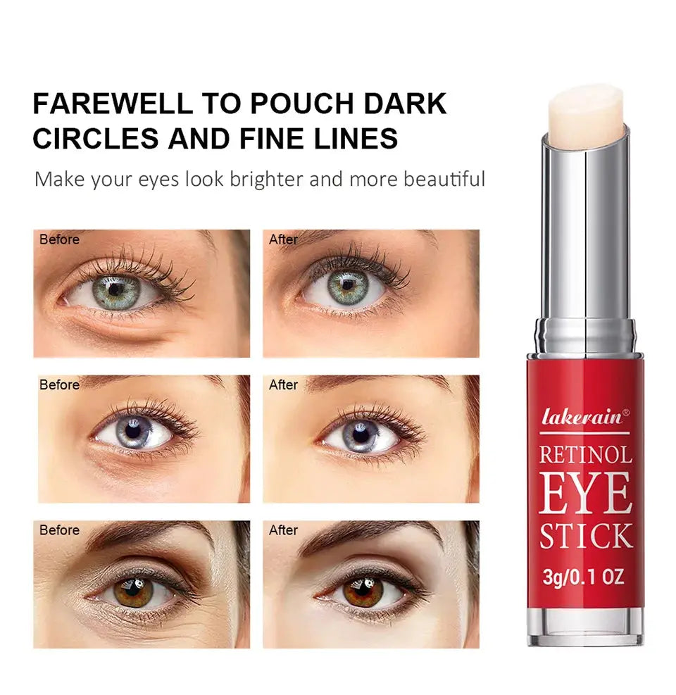 Retinol Eye Cream Lightening Dark Circles Firming Skin Instant Eye Repair Serum Stick for women Women Eyes Care NNOS