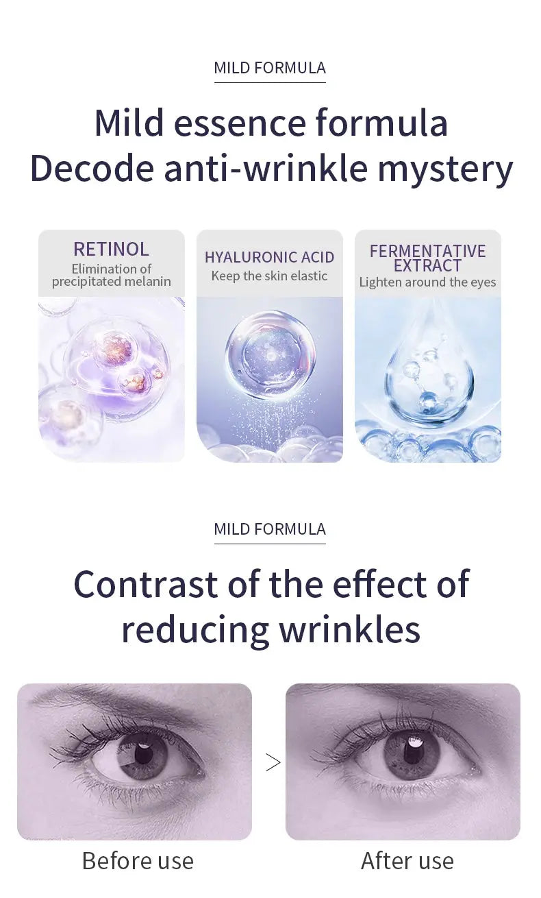 O'CHEAL Anti Wrinkle Anti Dark Circle Eye Cream Roller Massager Moisturizing Eye Bags Anti Aging Hyaluronic Acid Eye Skin Care NNOS