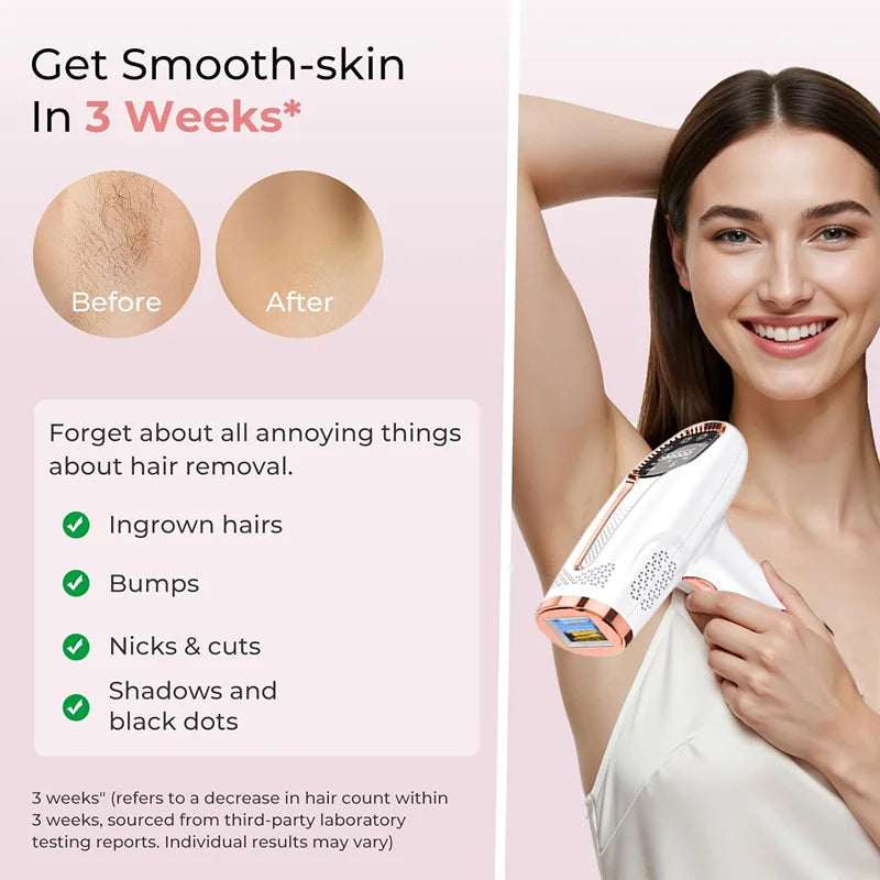 IPL Laser Hair Removal Device – Permanent Hair Removal At Home | Painless & Effective HomeWell Beauty